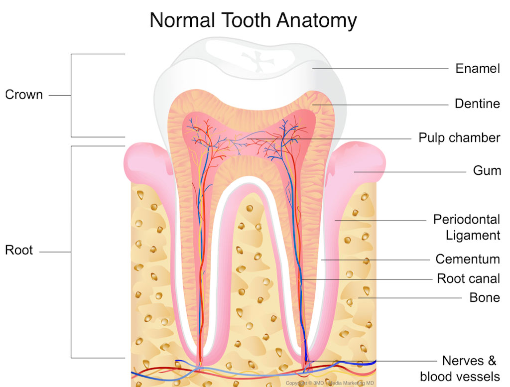 cavities dental caries